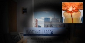 glaucoma laser treatment