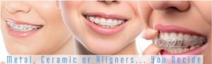 Metal braces are the most basic and common types of braces